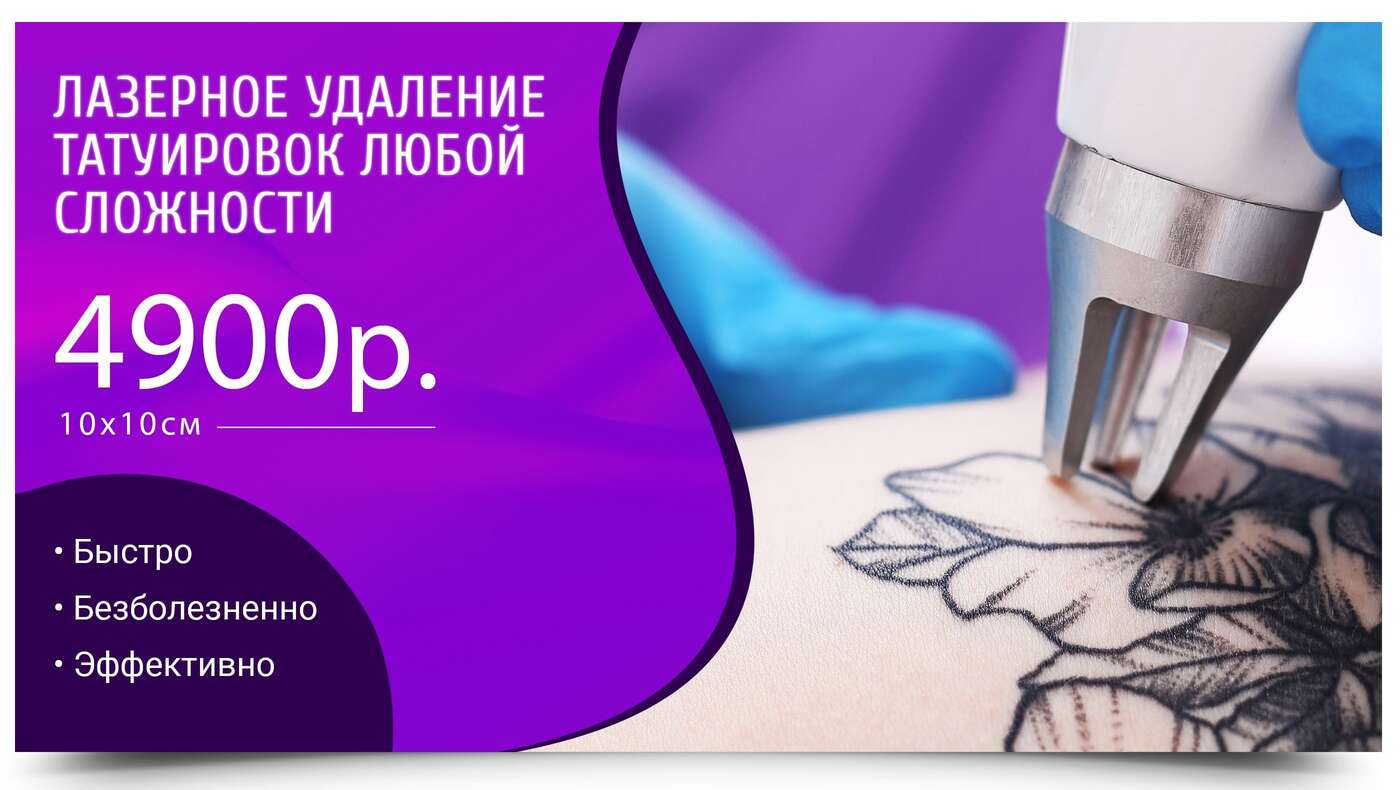 удаление тату