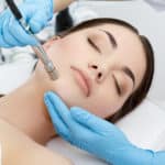 алмазный пилинг